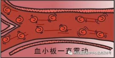 【科普】血小板是正常值的三倍？專家提醒小心血栓和出血！