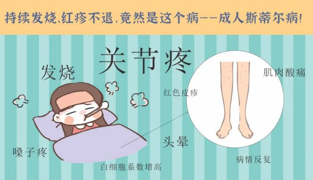 持續(xù)發(fā)燒、紅疹不退……她終于在這里治好了這個罕見病