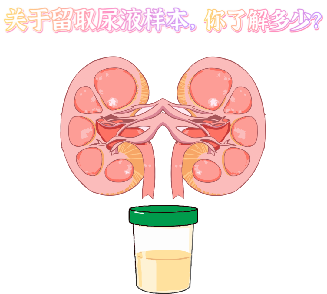 做尿檢，不得不說的注意事項！