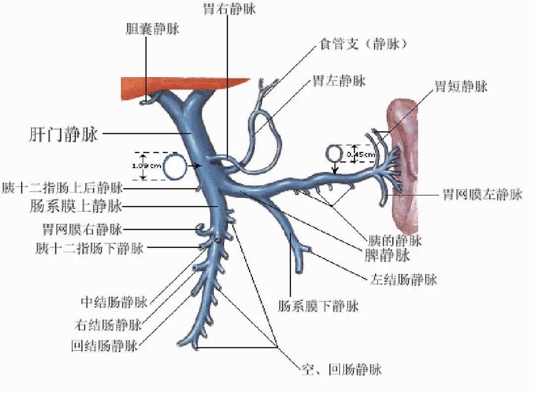 反復(fù)嘔血、黑便怎么辦？TIPS手術(shù)能解決