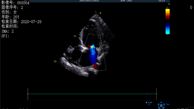 心電圖異常，心臟卻沒(méi)事，罪魁禍?zhǔn)资恰?>
				             </a>
                <div   id=