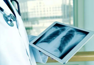 健康呼吸④體檢發(fā)現(xiàn)肺結(jié)節(jié)，我該怎么辦？