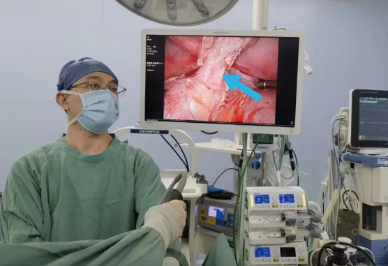 30歲小伙持續(xù)發(fā)燒咳嗽，原來(lái)是多長(zhǎng)一塊肺......