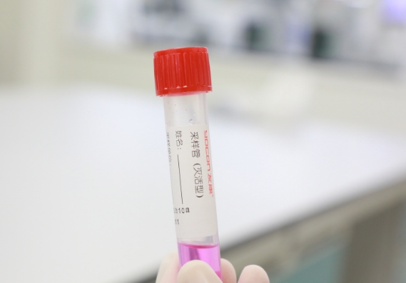 支原體感染檢測(cè)手段知多少？