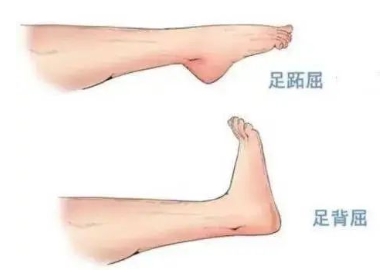 扭胯小連步、動感搖花手……“科目三”雖火，運(yùn)動損傷也要防！